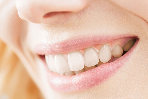 teeth whitening in blackburn lancashire